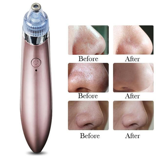 Blackhead Pore Vacuum Cleaner