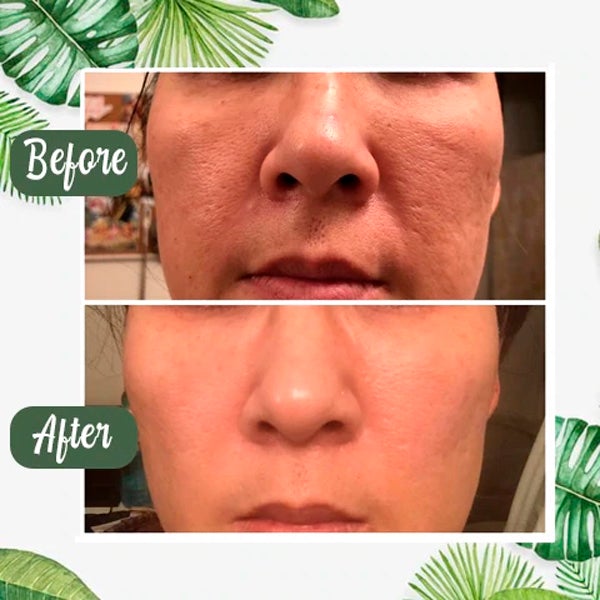 Greenglu Poreless Deep Cleanse Green Tea Mask